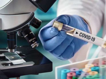 U FBiH 73 nova slučaja zaraze koronavirusom, 10 smrtnih ishoda